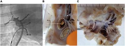 Profibrillatory Structural and Functional Properties of the Atrial-Pulmonary Junction in the Absence of Remodeling